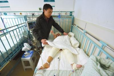 河北3歲女童掉進開水鍋 3次植皮手術花光積蓄